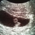 I have been wondering for a while how I would announce to you the gender of the child once we got to know it.  If it’s a girl, I’ll change my website to a pink theme and have balloons floating around was my first thought.  I did not have an idea what I’d do with a boy.  The thought lasted just a few seconds before I embarrassed myself with putting the child-to-be in gendered containers.  I myself had been fond of pink for a long time.  I remember a shopping trip during my primary school days when I demanded pink...