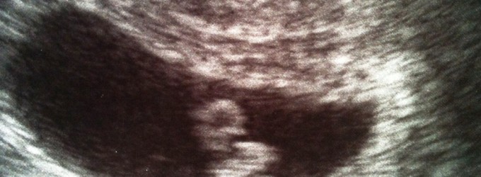 I have been wondering for a while how I would announce to you the gender of the child once we got to know it.  If it’s a girl, I’ll change my website to a pink theme and have balloons floating around was my first thought.  I did not have an idea what I’d do with a boy.  The thought lasted just a few seconds before I embarrassed myself with putting the child-to-be in gendered containers.  I myself had been fond of pink for a long time.  I remember a shopping trip during my primary school days when I demanded pink...